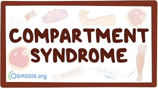 Compartment syndrome  an Osmosis Preview [upl. by Milak]