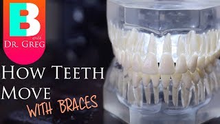 BRACES EXPLAINED How Teeth Move  Braces Work [upl. by Effie466]