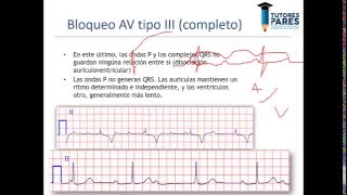 Arritmias en el electrocardiograma [upl. by Ettellocin459]