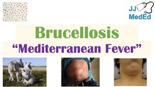 Brucellosis Mediterranean Fever  Transmission Pathogenesis Symptoms Diagnosis Treatment [upl. by Refinneg]