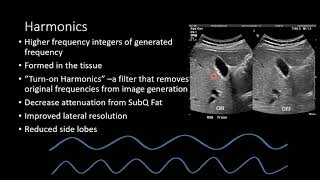 How Does Ultrasound Work [upl. by Yud]