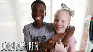 My Twin Sister Has Albinism  BORN DIFFERENT [upl. by Ycart181]