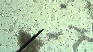 Protists Amoeba Euglena Paramecium [upl. by Seagraves720]