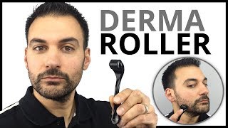 Derma Roller  Patchy Beard Growth Solution [upl. by Swagerty]