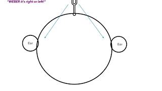 Weber vs Rinne Test amp Conductive vs Sensorineural Hearing Loss [upl. by Niela]