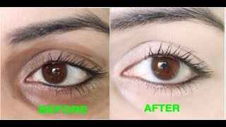 How to Remove Dark Circles Naturally in 3 Days 100 Results [upl. by Lorolla]