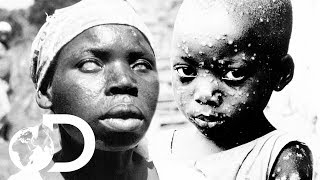 The Eradication Of Smallpox  Invisible Killers [upl. by Llehsem]