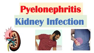 Pyelonephritis Kidney Infection  Causes Pathophysiology Signs amp Symptoms Diagnosis Treatment [upl. by Essined]