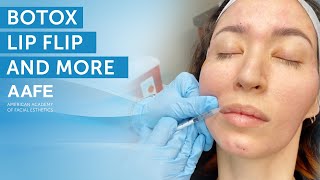 Botox Lip Flip Treatment  More  AAFE [upl. by Kiel]