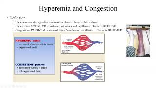 Pathology Made Easy 4 Hemodynamic Disorders [upl. by Allyce]