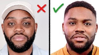 Remove DARK CIRCLES Under Your Eyes How I Did It Mens Skin Care [upl. by Ylas491]