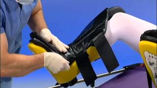 Allen Medical  Allen Stirrups  Instructional Video [upl. by Lalitta]