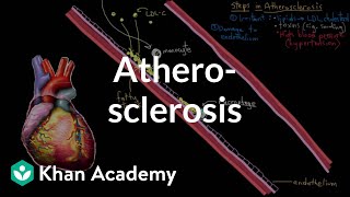 Atherosclerosis  Circulatory System and Disease  NCLEXRN  Khan Academy [upl. by Evy]