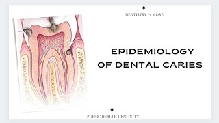 EPIDEMIOLOGY OF DENTAL CARIES [upl. by Abigael191]