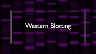 Western Blot Protocol Overview [upl. by Kaela489]