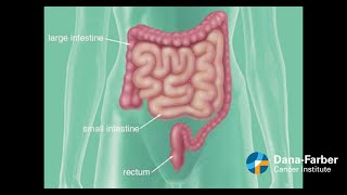 Dr McCann on Prognosis for Patients With HER2Positive Breast Cancer [upl. by Esinehc494]