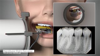 DEXIS™ Titanium by KaVo  Full Mouth Series Positioning Guide [upl. by Heisser]