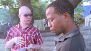 Albino journalist fights deadly stereotype  Africa on the Move [upl. by Tu65]