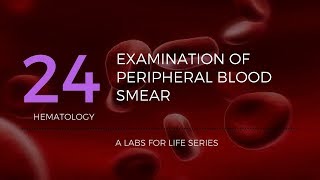 Part 2  Examination of Peripheral Blood Smear [upl. by Becket]