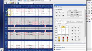 Dentrix step by step  Perio charting [upl. by Ytok77]