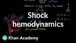 Stroke Haemorrhagic transformation  radiology video tutorial CT MRI [upl. by Asiilanna]