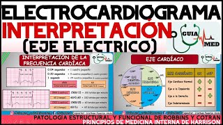 ELECTROCARDIOGRAMA INTERPRETACIÓN  GuiaMed [upl. by Aliak]