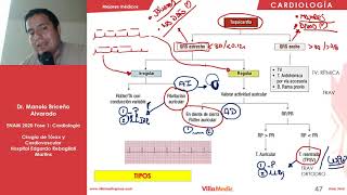 CARDIO  Arritmias Cardíacas  ENAM 2020 [upl. by Corney801]