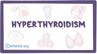 Hyperthyroidism  an Osmosis Preview [upl. by Dimitris695]