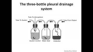 CHEST TUBE amp DRAINAGE SYSTEM [upl. by Mathur680]