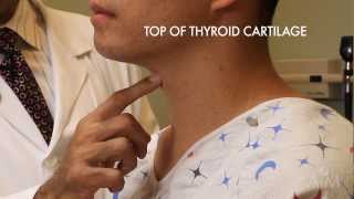 The Thyroid Exam Stanford Medicine 25 [upl. by Sevy598]