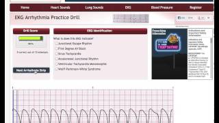 Easy EKG Rhythm Interpretation Part 2 [upl. by Nillek255]