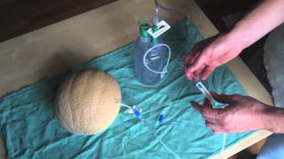 Paracentesis using Turkel Safety Fluid Drainage System [upl. by Ahseenal754]