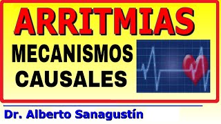 ARRITMIAS 2 MECANISMOS DE PRODUCCIÓN  Fisiopatología [upl. by Welbie]