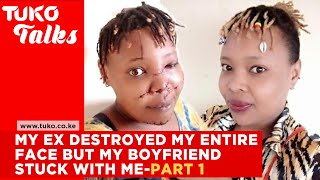 My ex destroyed my face said no other man will ever have me PART 1  Tuko Talks [upl. by Nilyak]