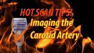 Secrets of Carotid Ultrasound [upl. by Tsenre525]