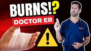 How to Treat a Second Degree Burn  Auburn Medical Group [upl. by Muire452]