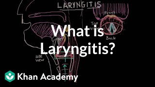 What is laryngitis   Respiratory system diseases  NCLEXRN  Khan Academy [upl. by Spiegleman]