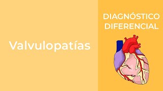 Diagnóstico Diferencial Valvulopatías [upl. by Akirat]