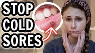 How to treat cold sores FAST Dr Dray [upl. by Levy]