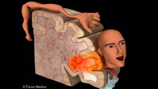 Primary Motor Cortex  Neuroanatomy [upl. by Nickola803]