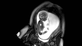 Foetal Development Unborn Baby Movement at 24 Weeks  WIRED [upl. by Eryt]