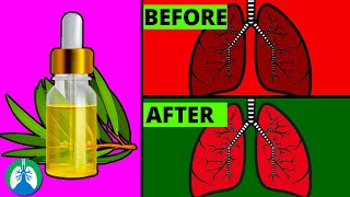 How to Cleanse Your Lungs with Tea Tree Oil [upl. by Anceline]