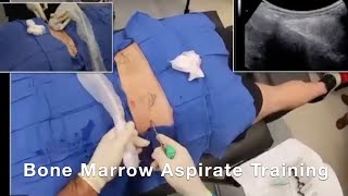 Bone Marrow Aspirate Training Highlight Reel [upl. by Ennazus765]