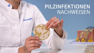 Hautpilz erkennen  So funktionert der Nachweis │Dr med Alice Martin [upl. by Chicoine]