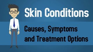 Skin Conditions  Causes Symptoms and Treatment Options [upl. by Mayor]