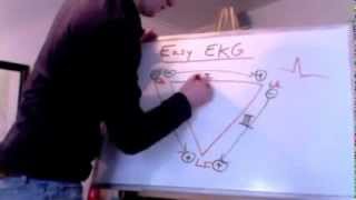 Easy EKG Einthovens Triangle [upl. by Fotina759]