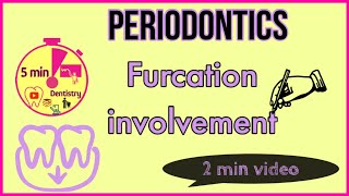 FURCATION INVOLVEMENT  Glickmans classification in 2 minutes  Periodontics [upl. by Eddy]