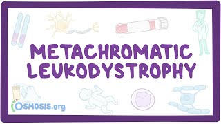 Metachromatic leukodystrophy  causes symptoms diagnosis treatment pathology [upl. by Assili798]