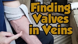 Finding Valves in Veins [upl. by Idet480]