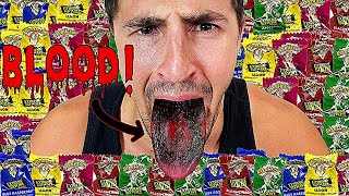 Eating WARHEADS Until My Mouth BLEEDS Challenge  Bodybuilder VS Extreme Sour Candy Experiment [upl. by Leisam]